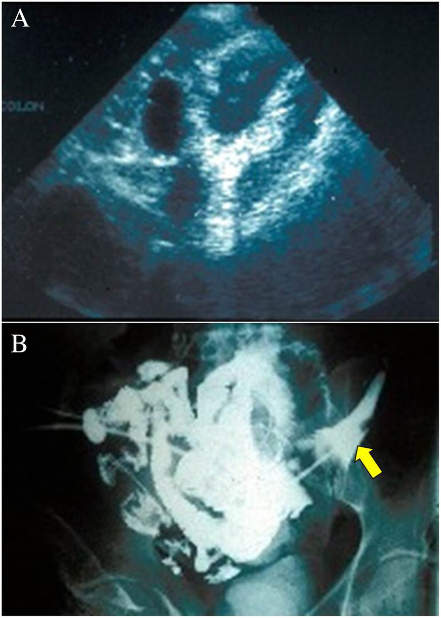 Fig. 4