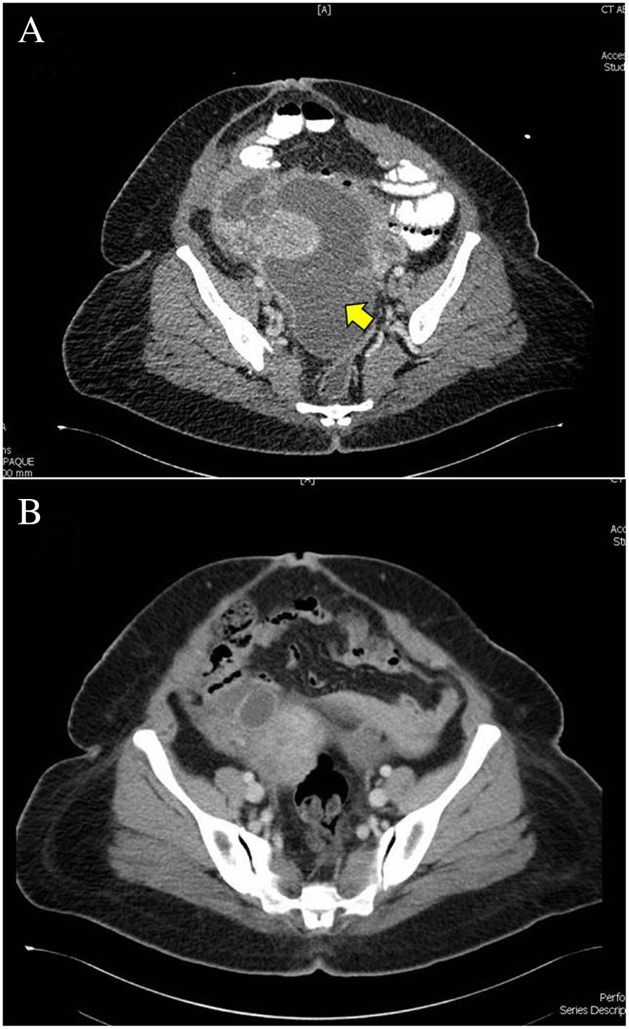 Fig. 5