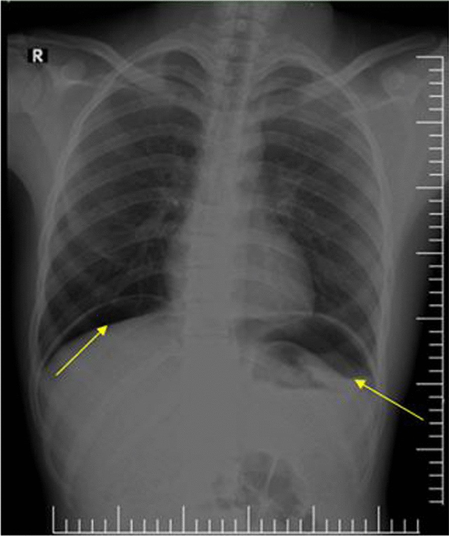 Fig. 2