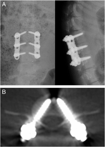 Fig. 5