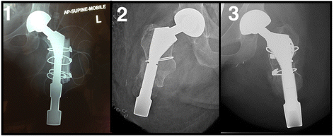 Fig. 5