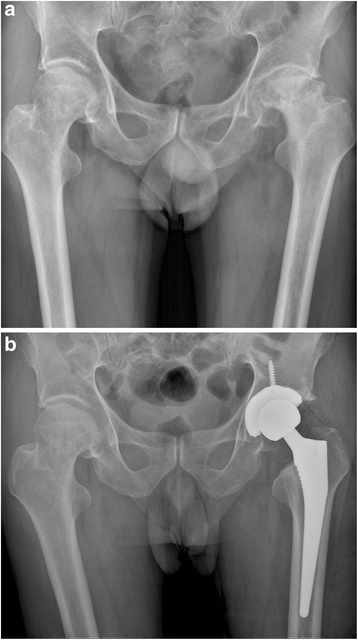 Fig. 11