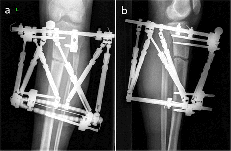 Fig. 4