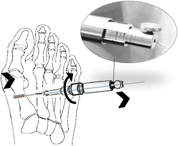 Fig. 2