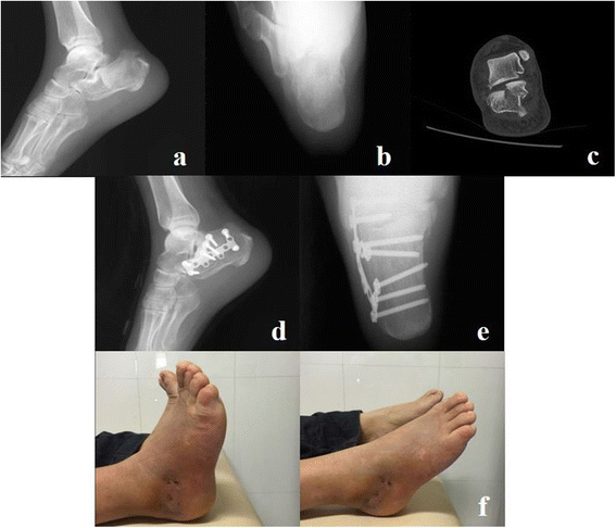 Fig. 3