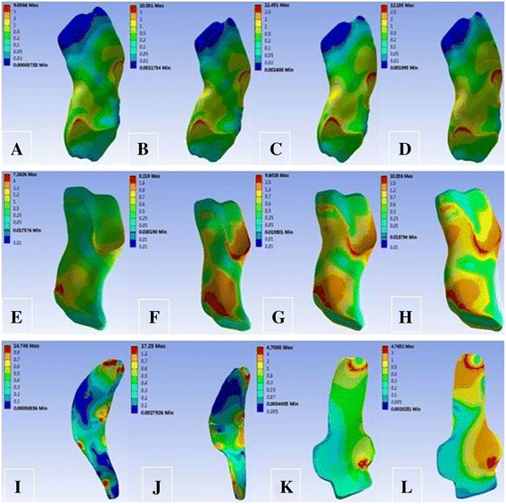 The Evaluation Of The Role Of Medial Collateral Ligament Maintaining Knee Stability By A Finite Element Analysis Journal Of Orthopaedic Surgery And Research Full Text