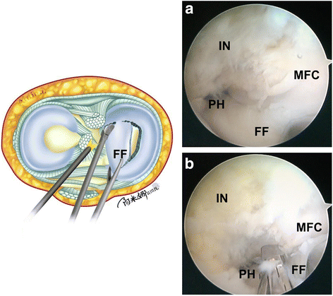 Fig. 5