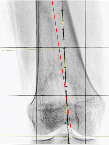 Fig. 5