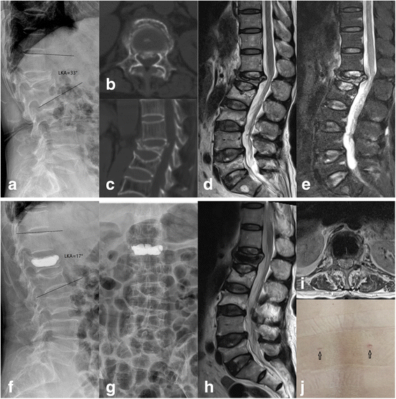 Fig.2