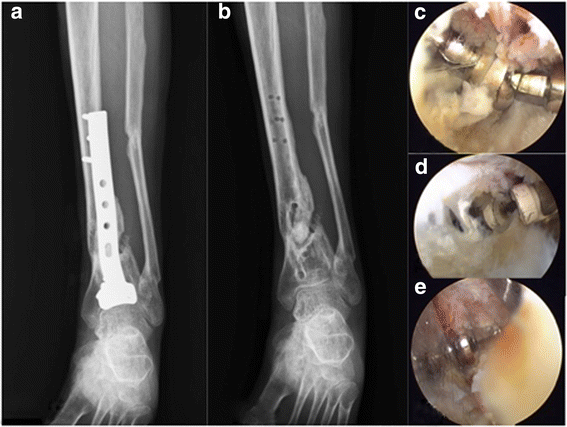 Fig. 5