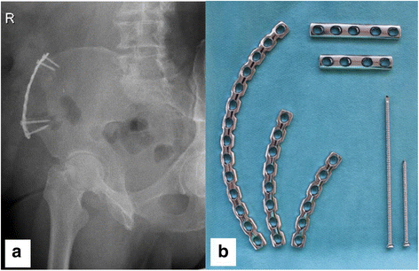 Fig. 6