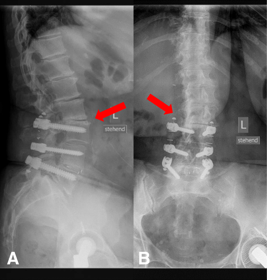 Fig. 10