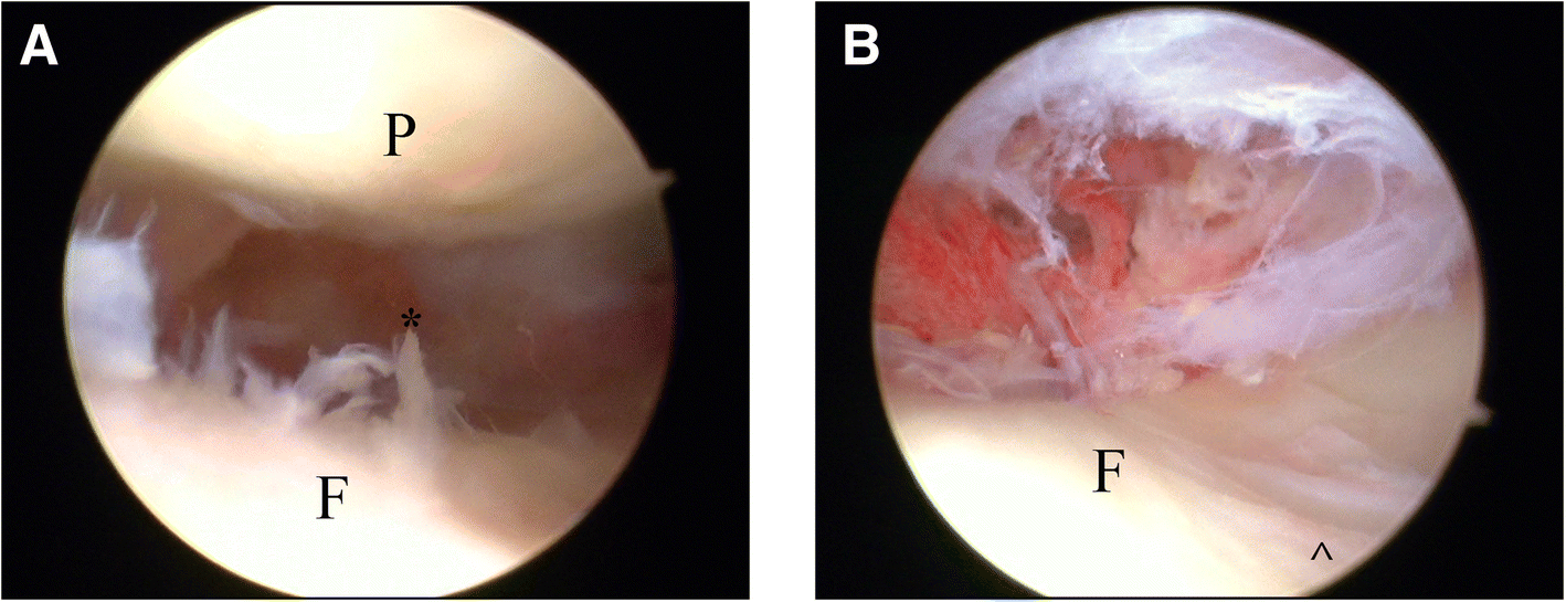 Fig. 10