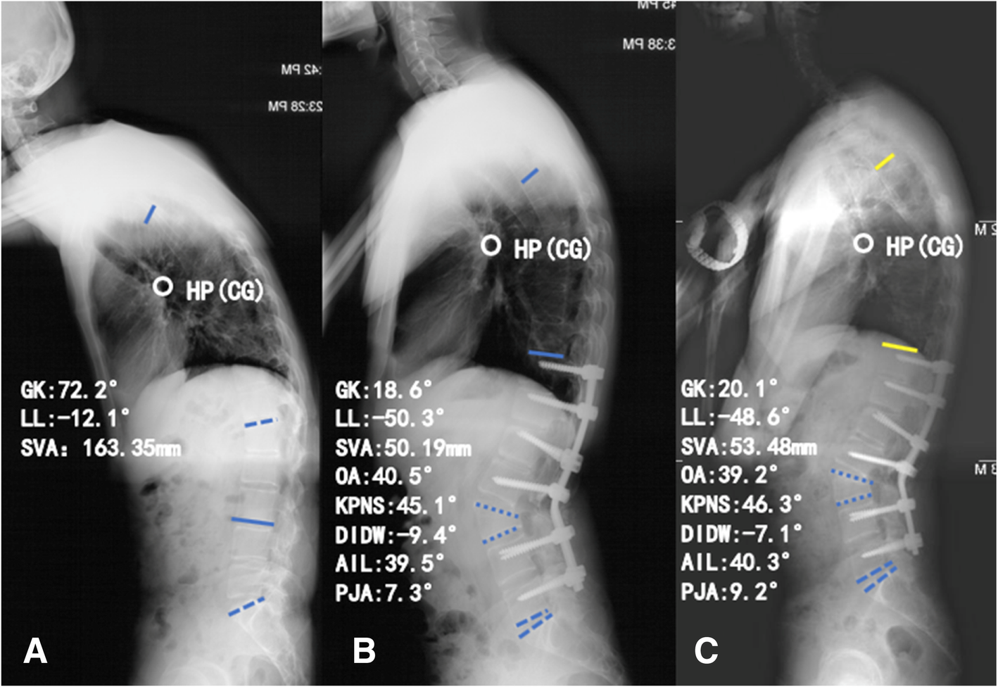 Fig. 2