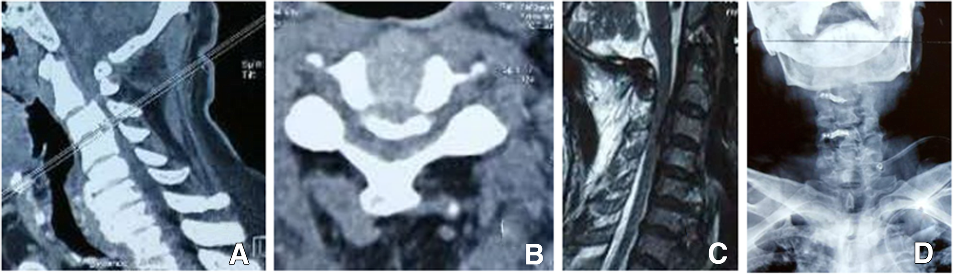 Fig. 2