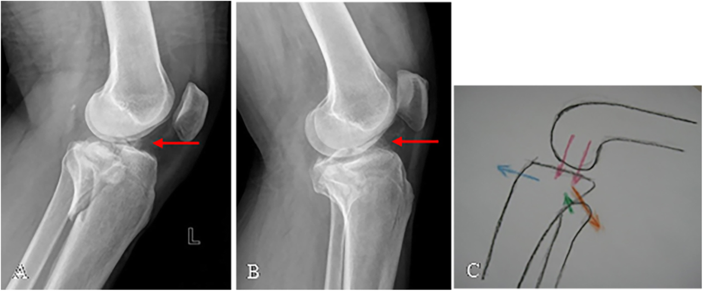 Fig. 7