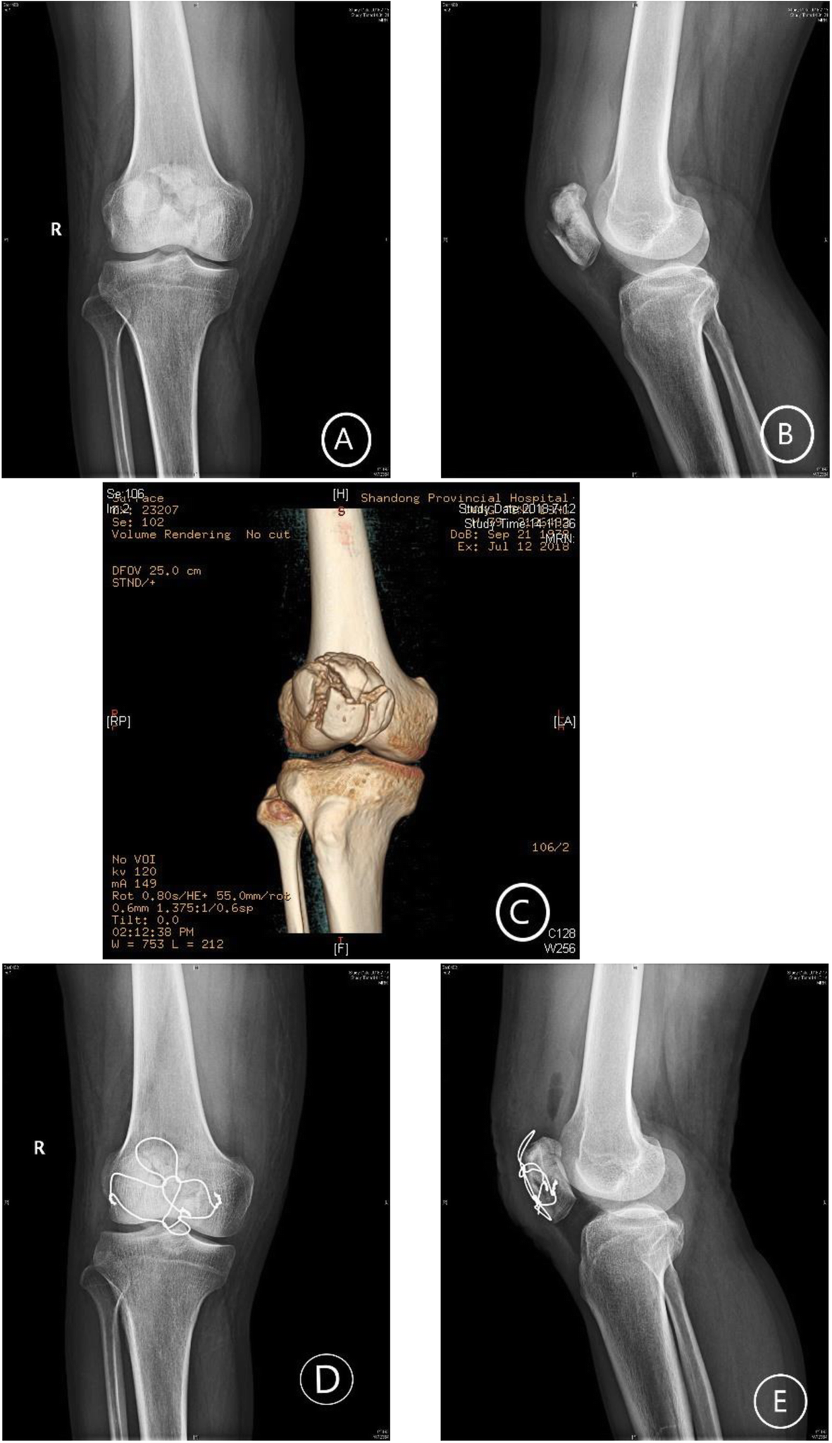 Fig. 3