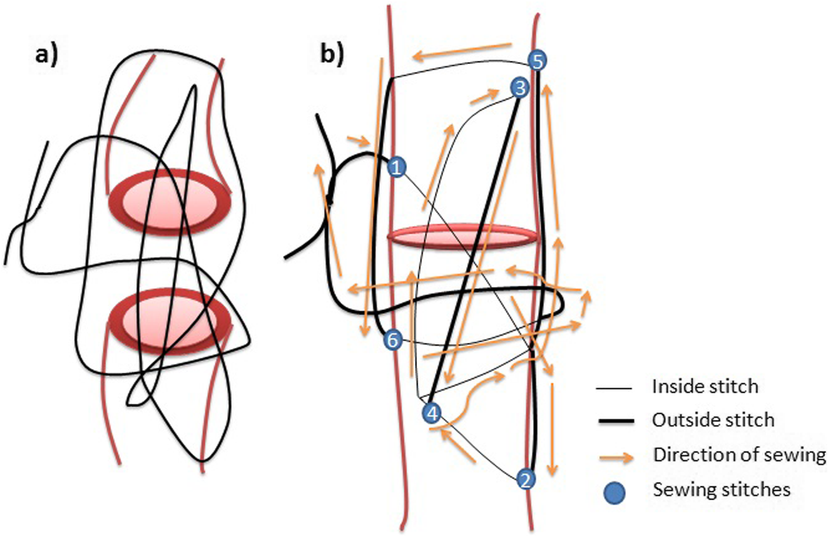 Fig. 2