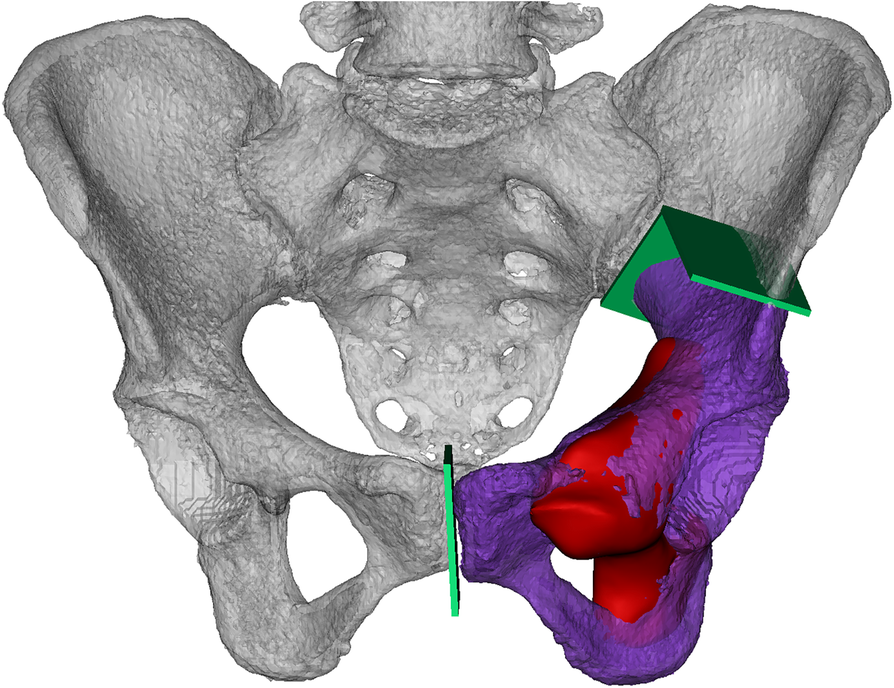 Fig. 2