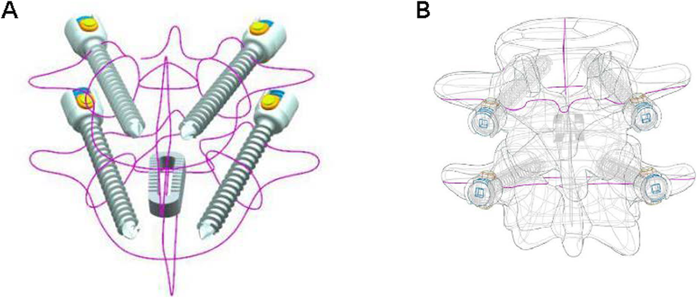 Fig. 4