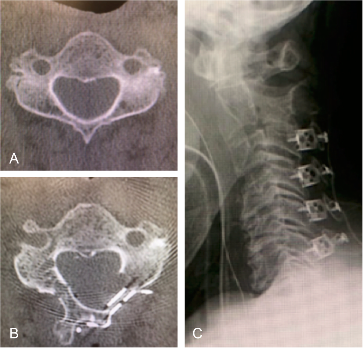 Fig. 1