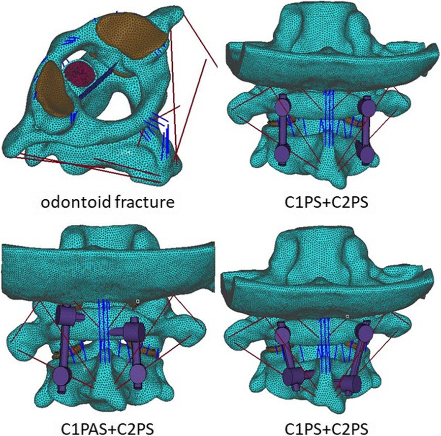 Fig. 2