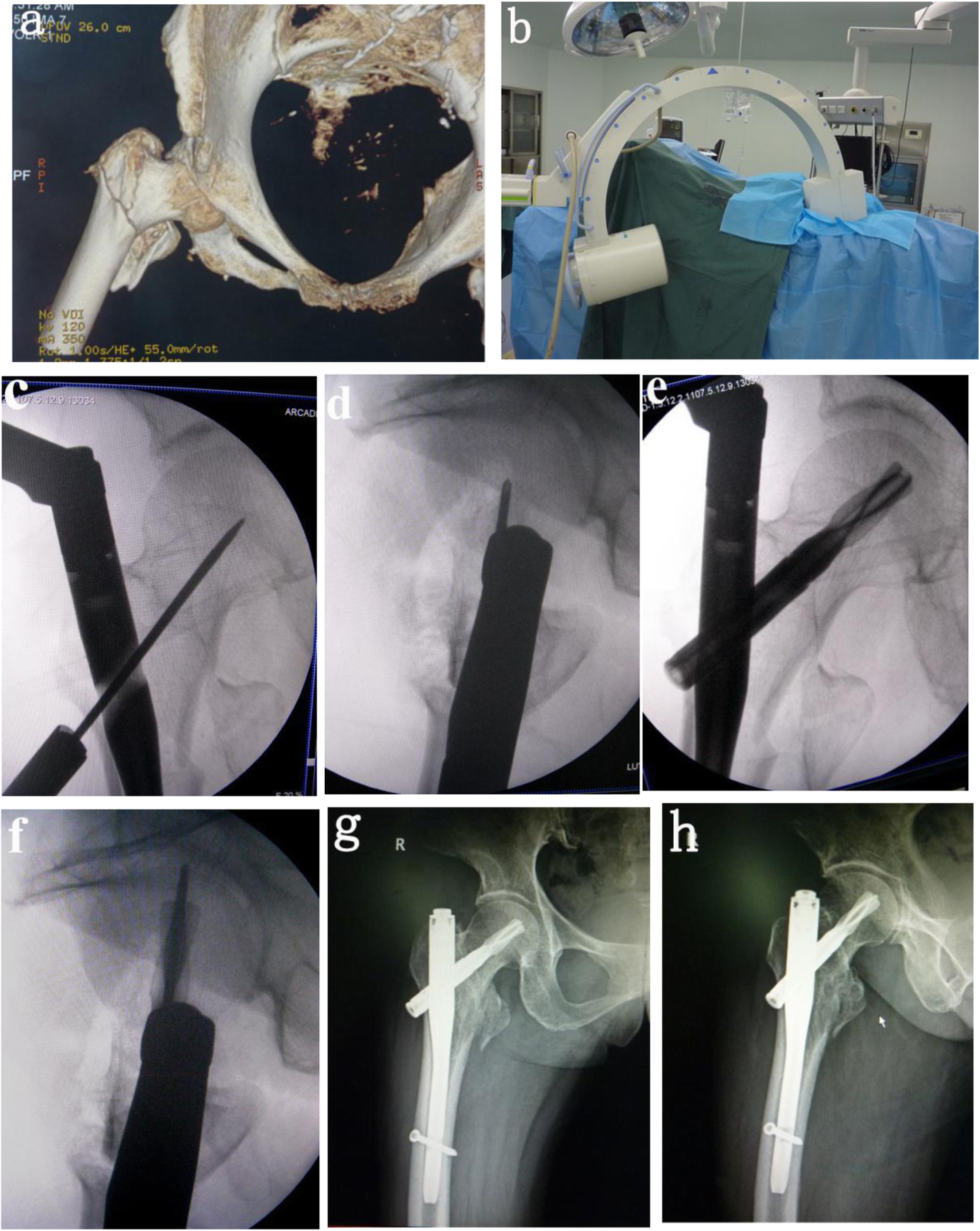 Fig. 2