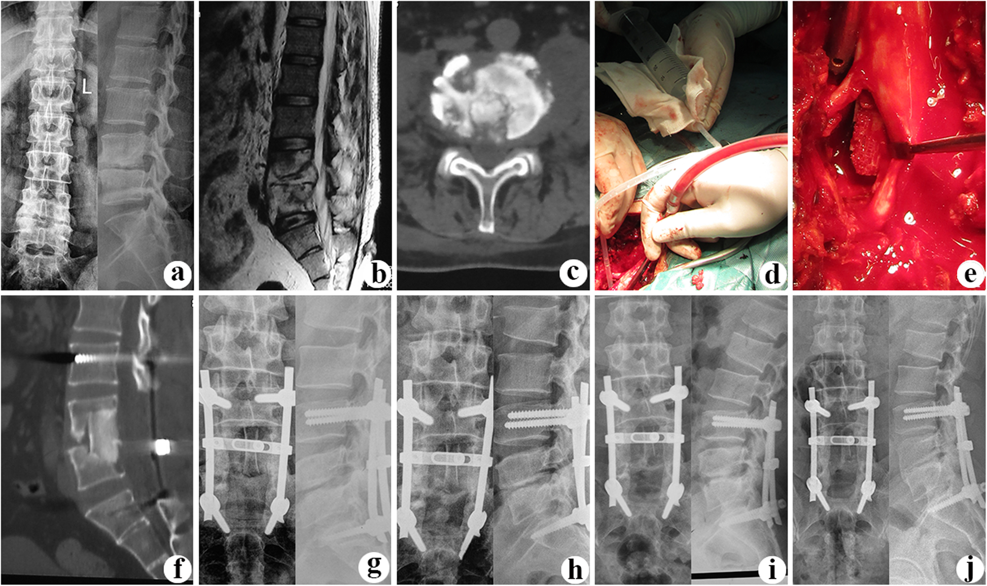 Fig.1