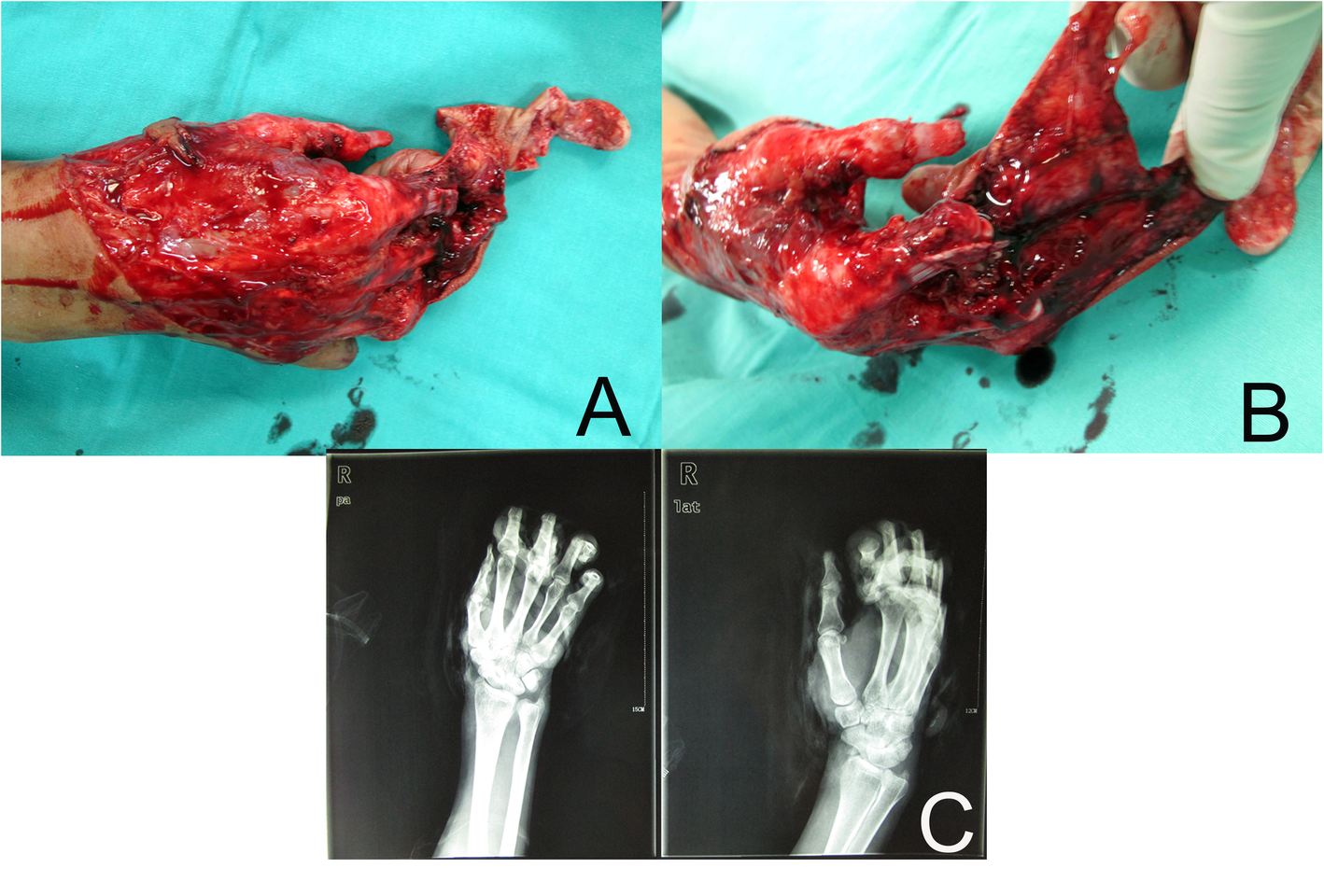 Fig. 2