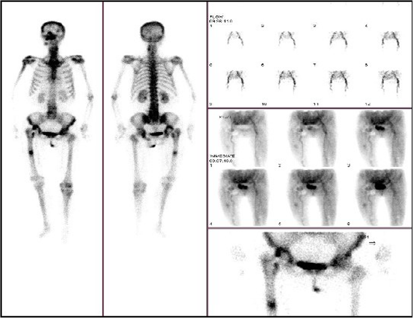 Fig. 18