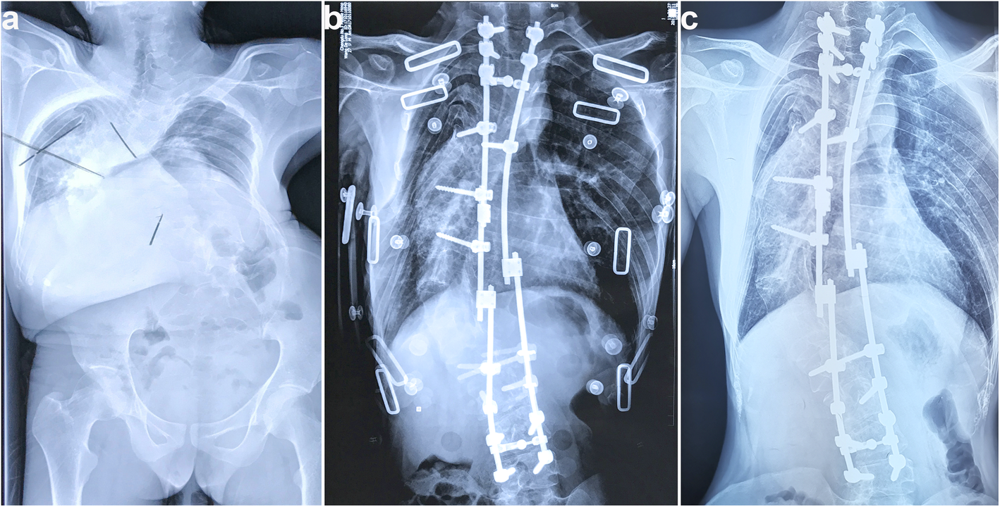 Fig. 7