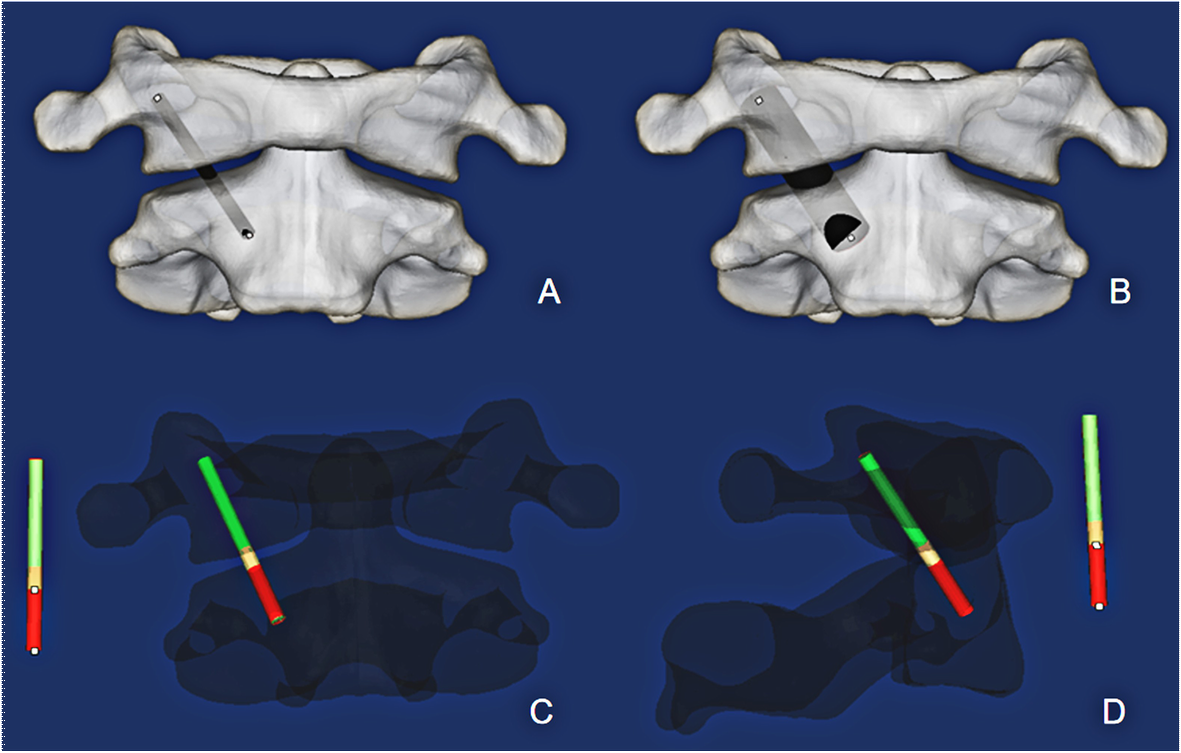 Fig. 2