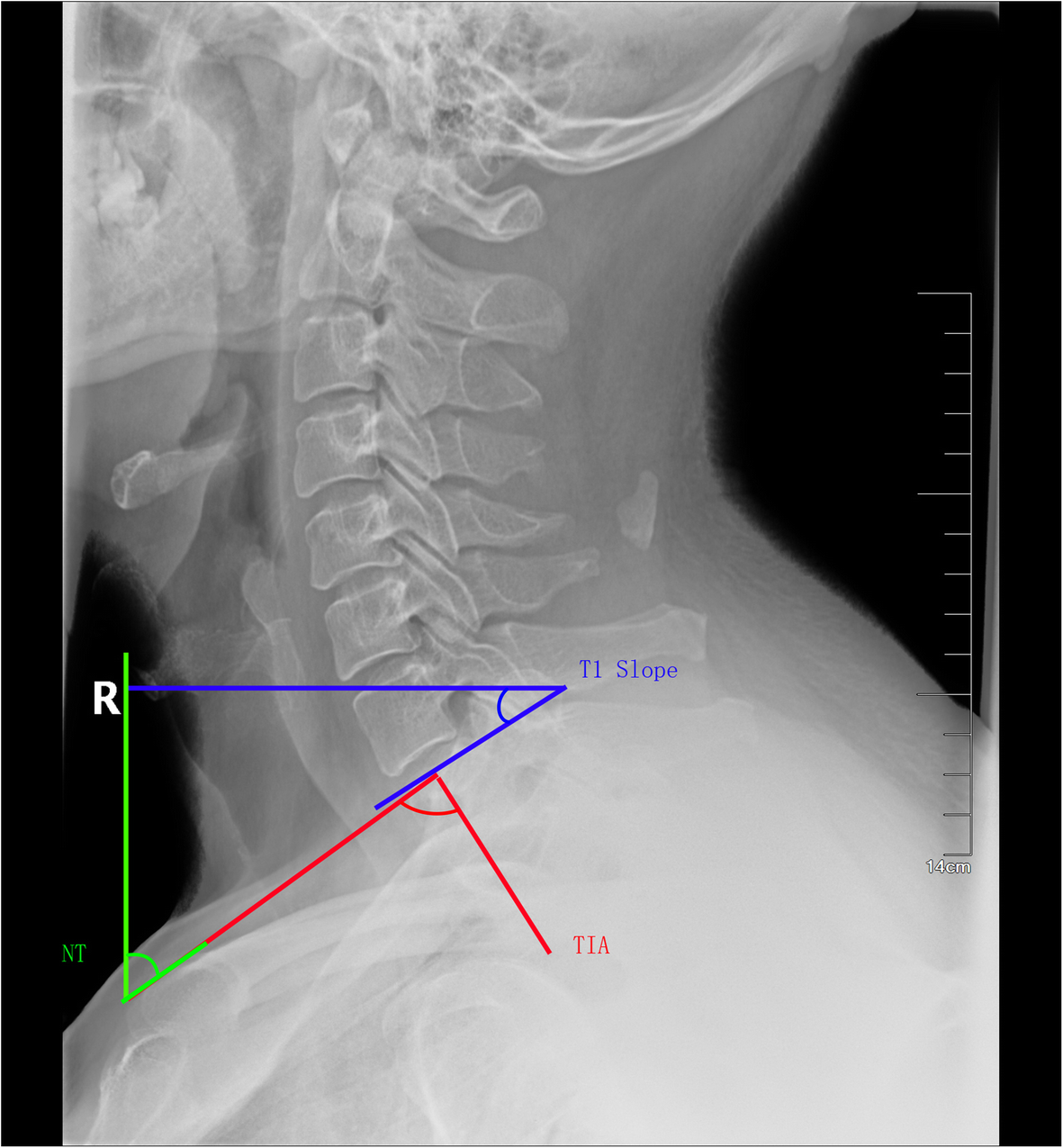 Fig. 3