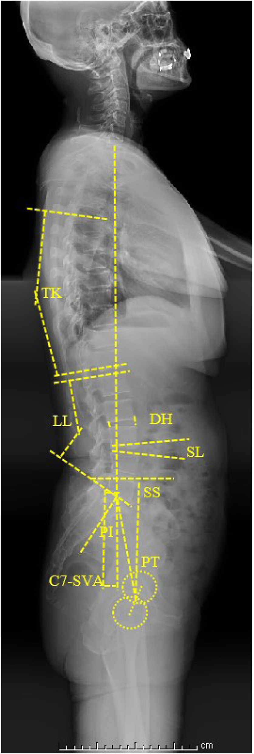 Fig. 1