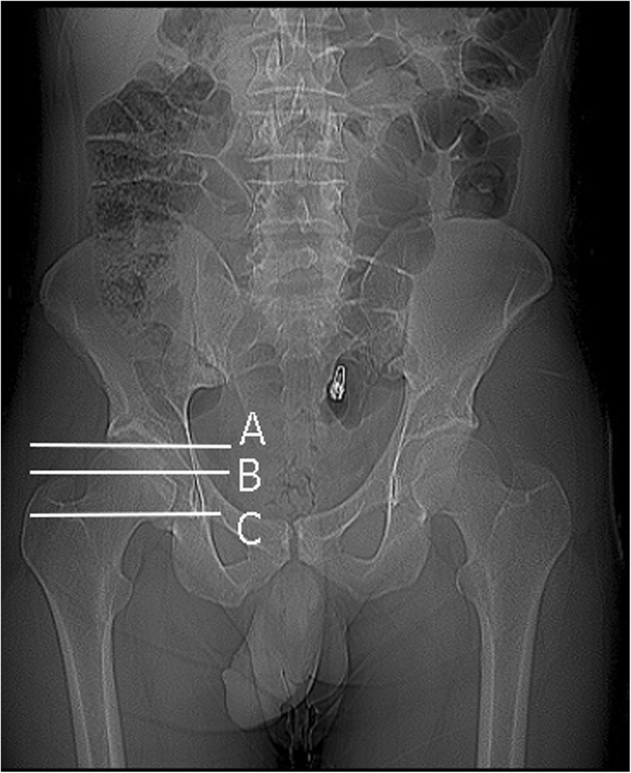 Fig. 2