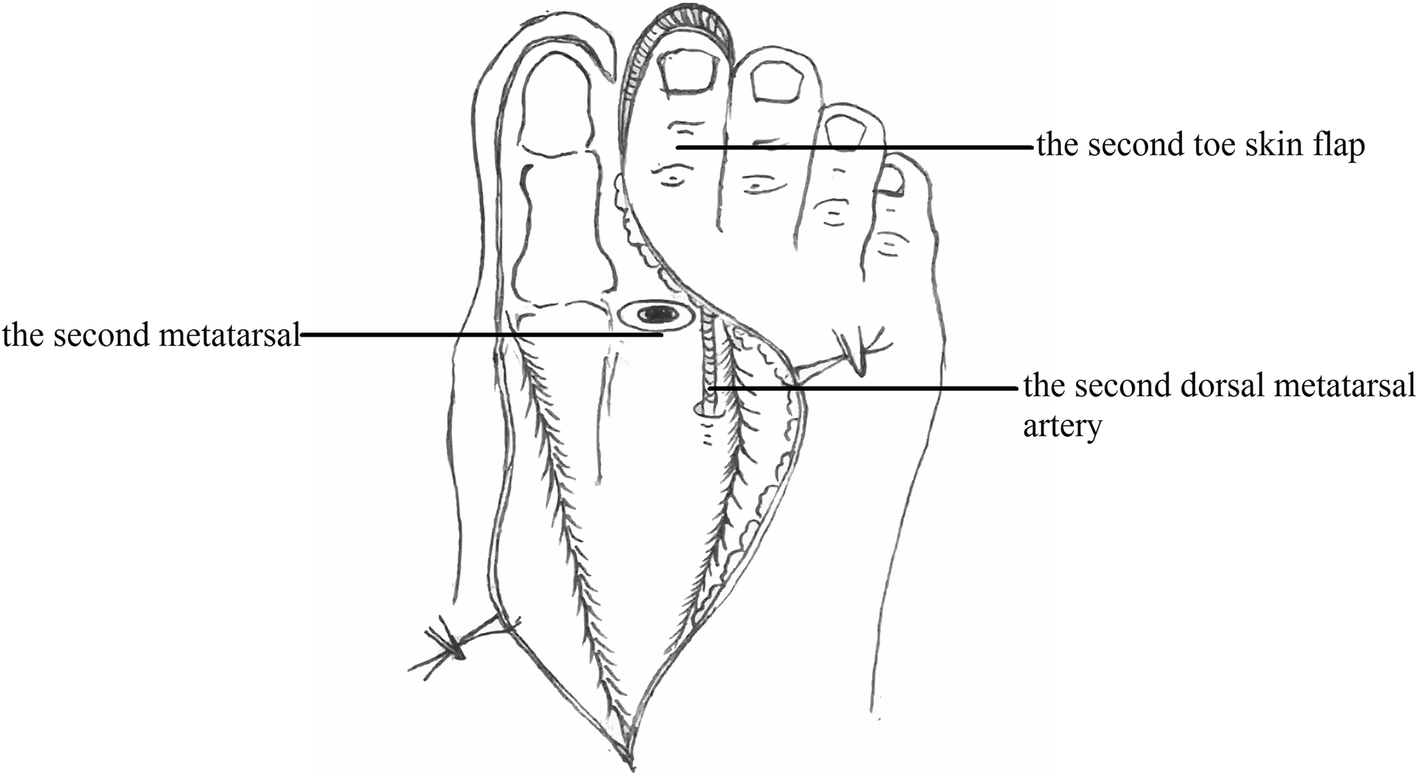 Fig. 2