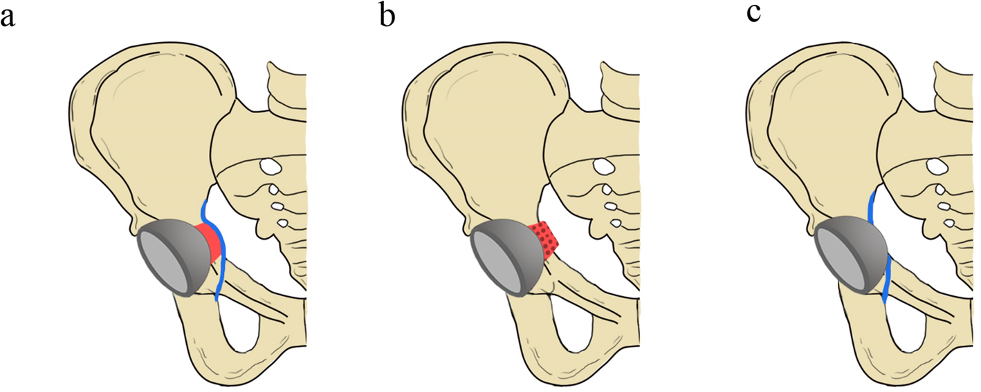 Fig. 5