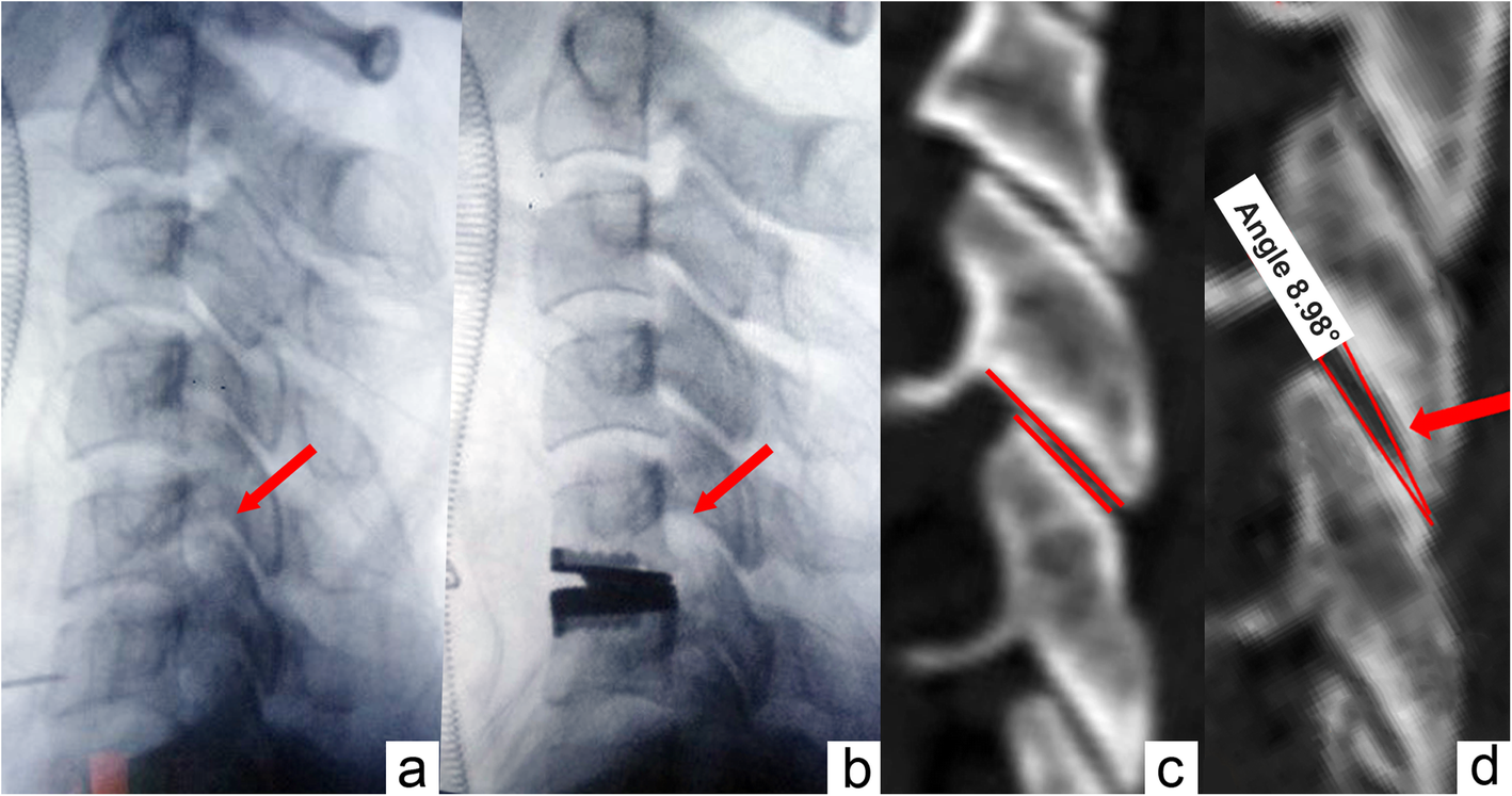 Fig. 6