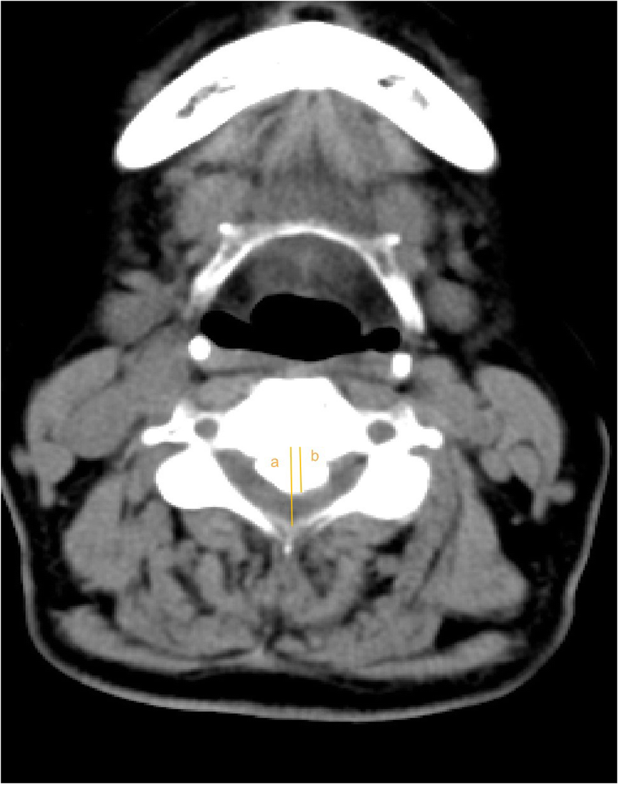 Fig. 3