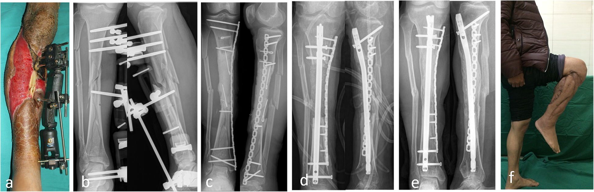 Fig. 2