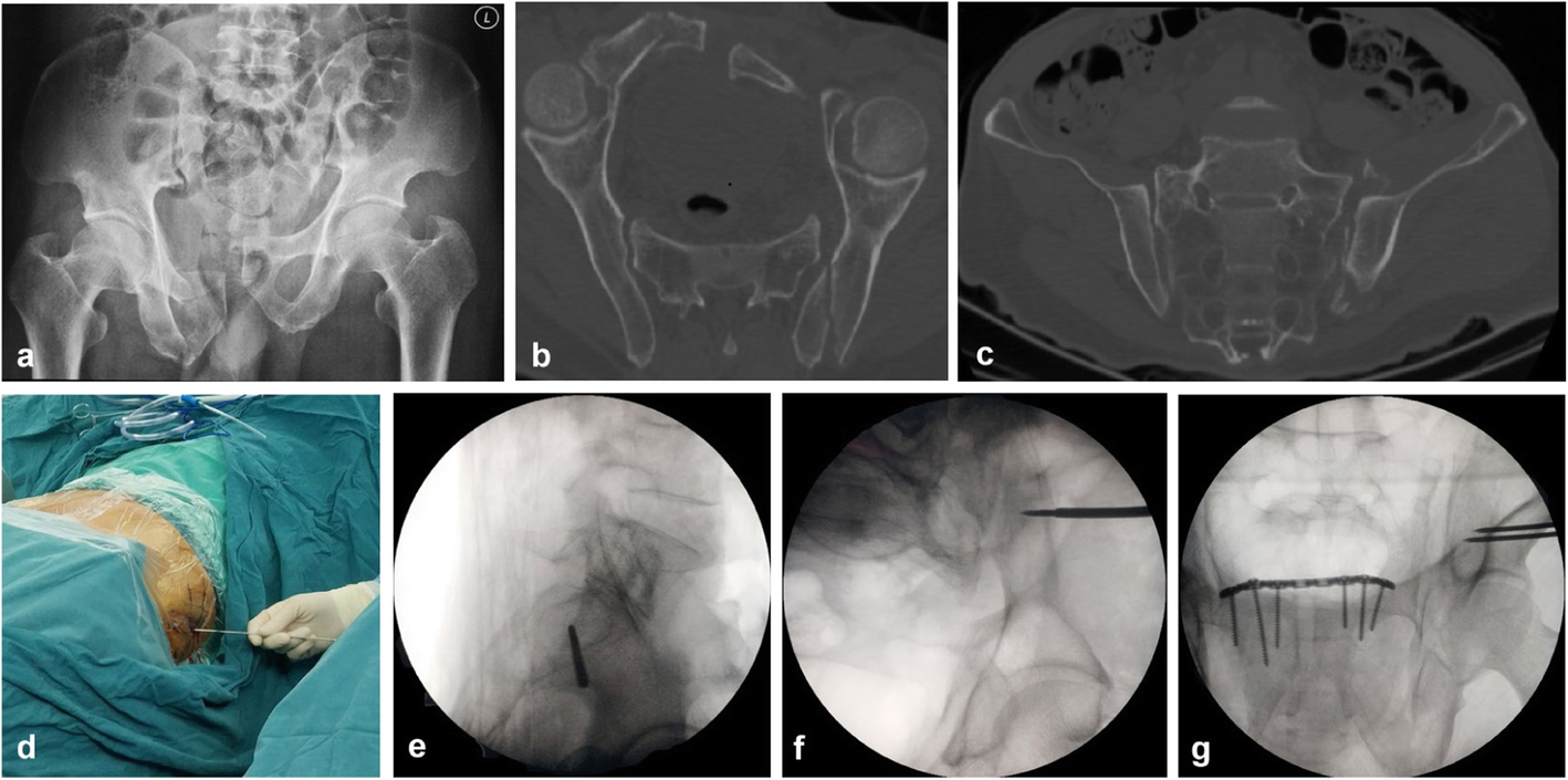 Fig. 2