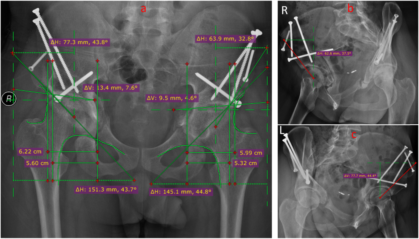 Fig. 4