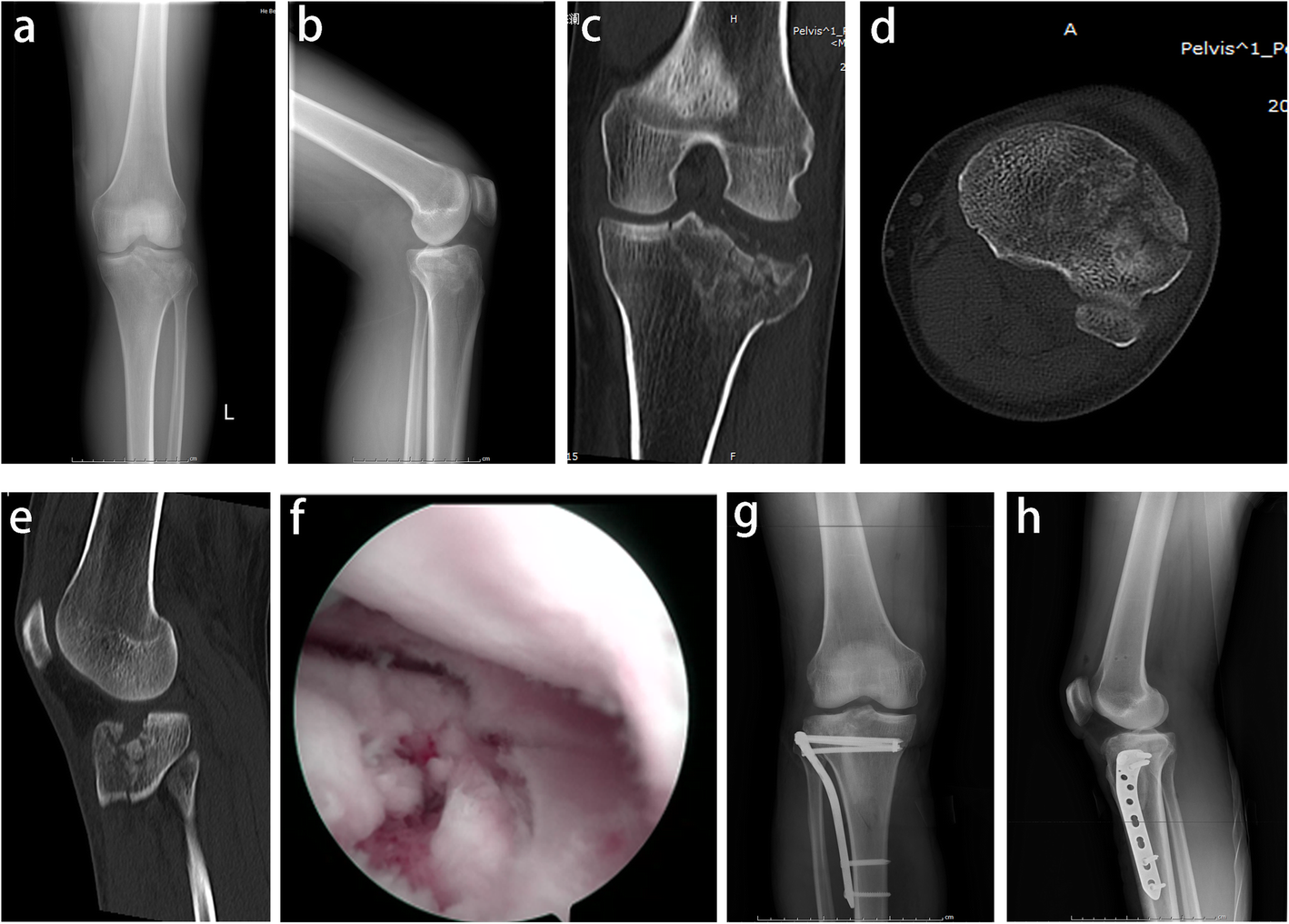 Fig. 2