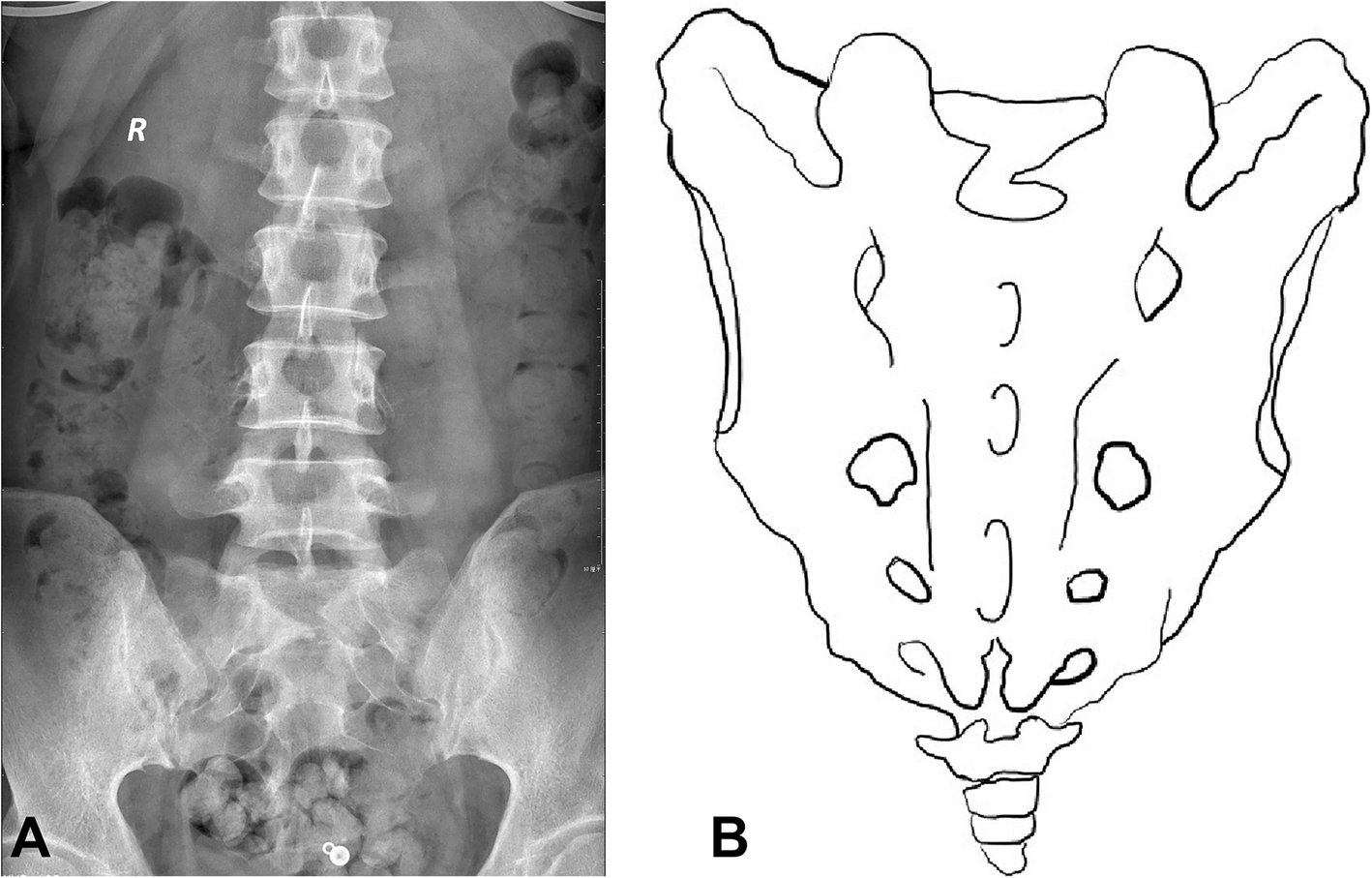 Fig. 4