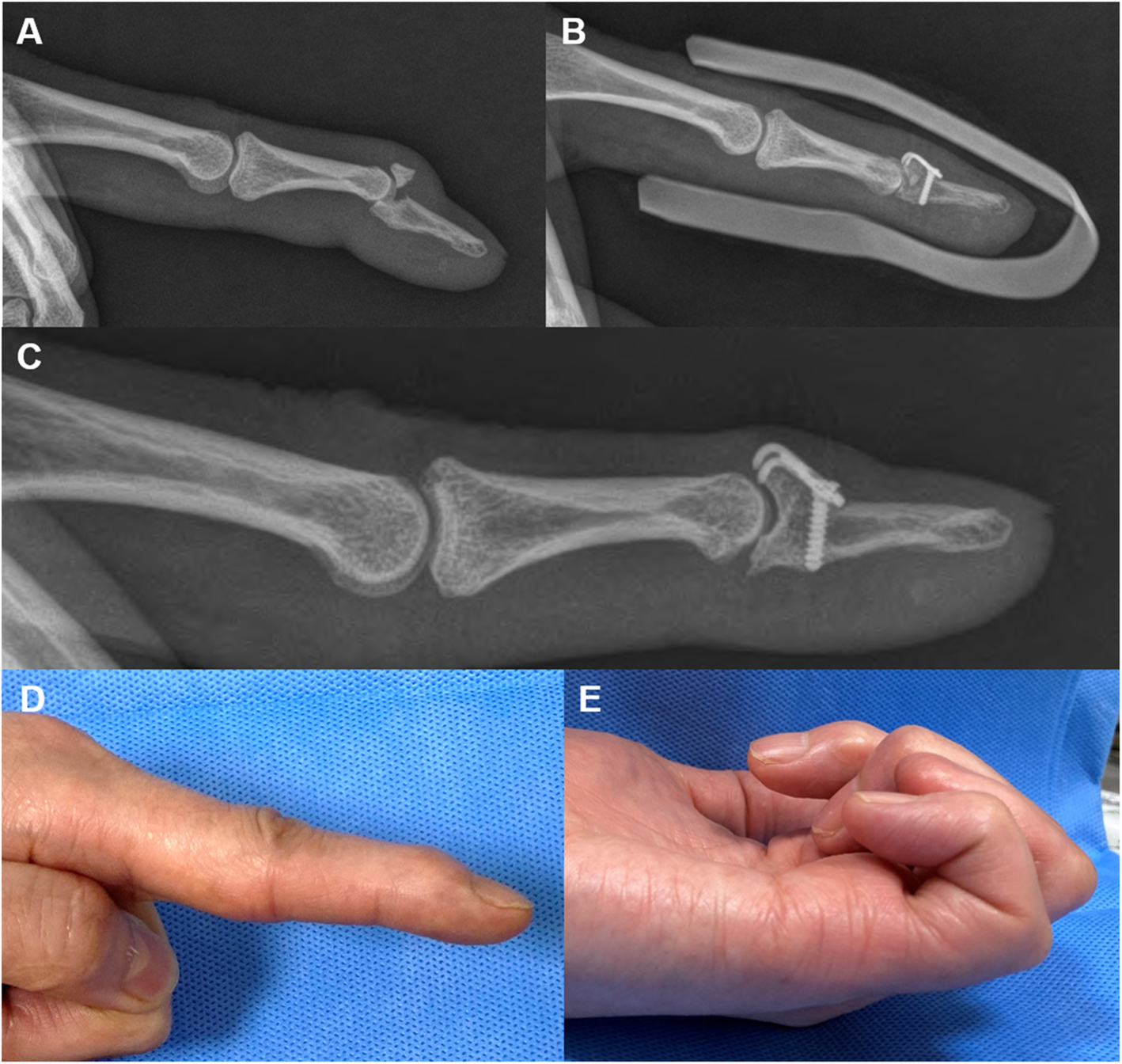 Fig. 1