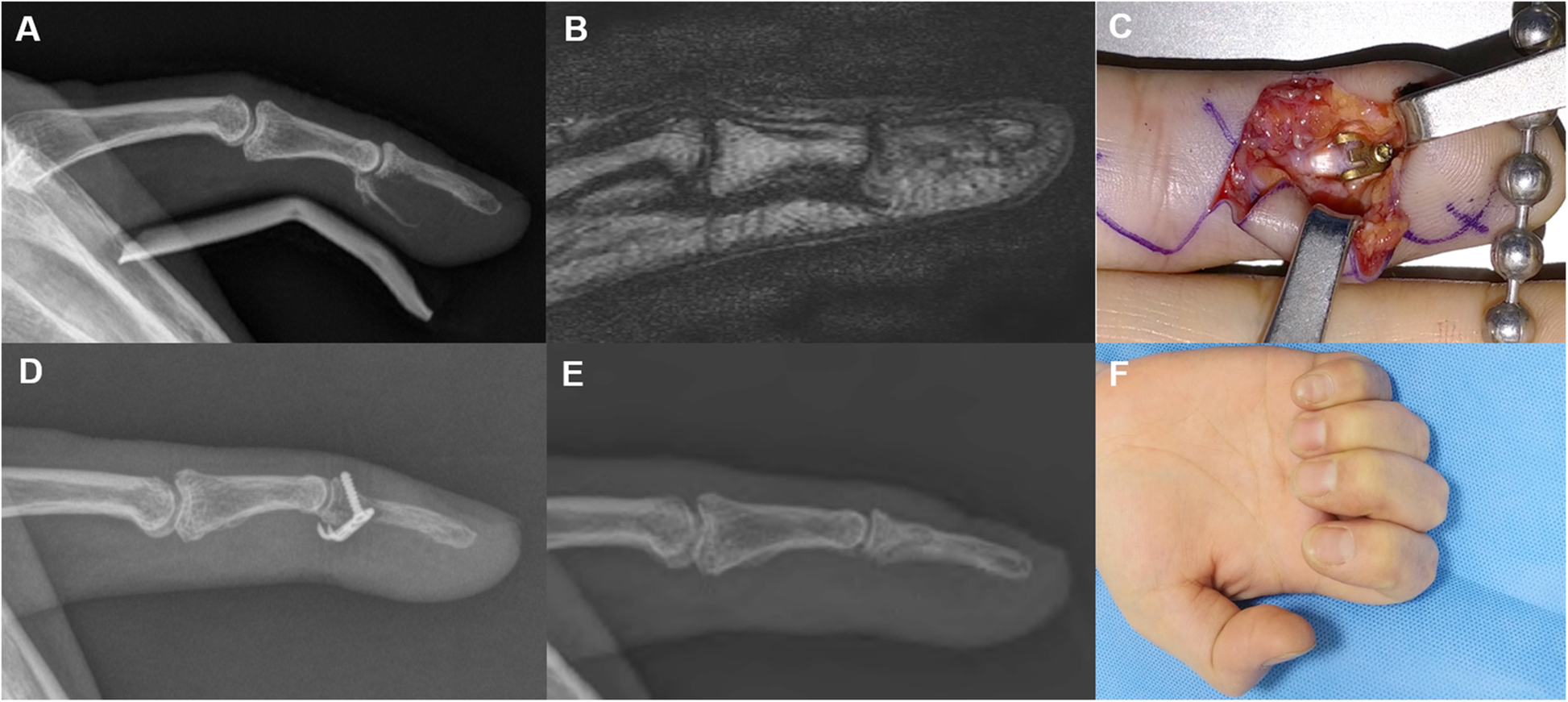 Fig. 5