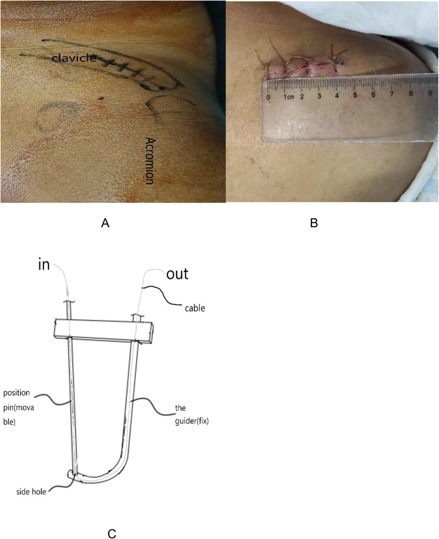 Fig. 1