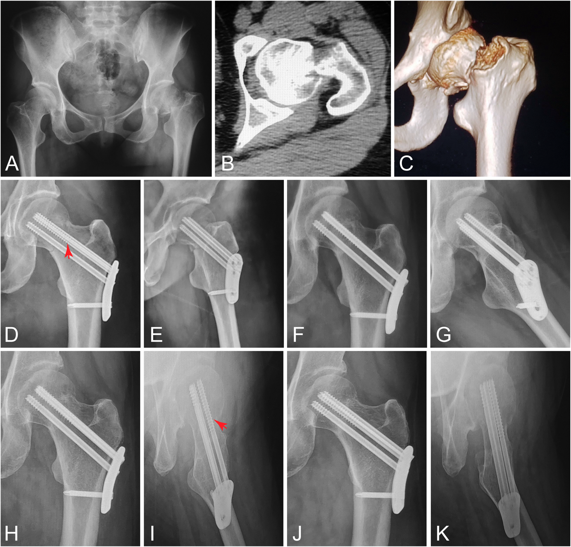 Fig. 1