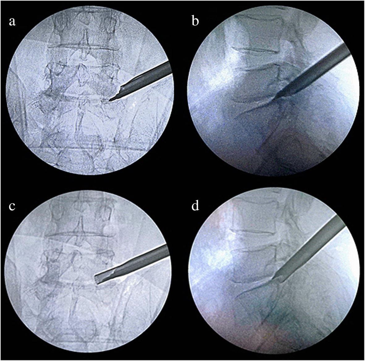 Fig. 3