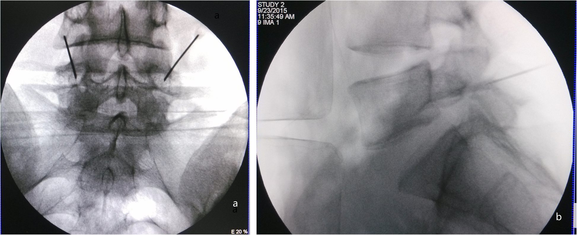 Fig. 1